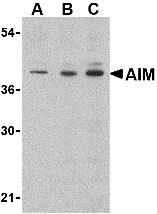 1 - AIM Antibody ASC10419