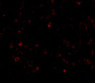 3 - AIM Antibody ASC10420