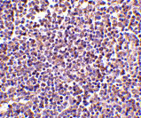 2 - AIM Antibody ASC10420