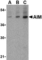 1 - AIM Antibody ASC10420