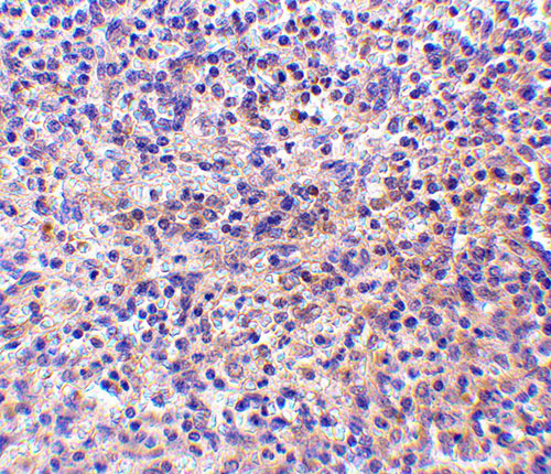 2 - RP105 Antibody ASC10428