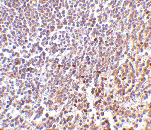 2 - MD-1 Antibody ASC10431