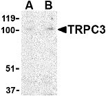 1 - TRPC3 Antibody ASC10449