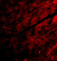 3 - TRPC3 Antibody ASC10454