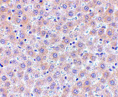 2 - sRANK Ligand Antibody ASC10470