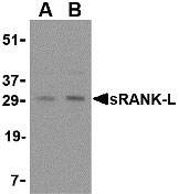 1 - sRANK Ligand Antibody ASC10470