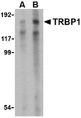 1 - TRBP1 Antibody ASC10487