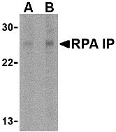 1 - RPA Interacting Protein Antibody ASC10488