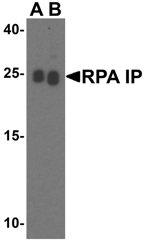 1 - RPA Interacting Protein Antibody ASC10489