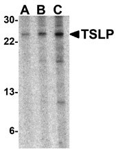 1 - TSLP Antibody ASC10494