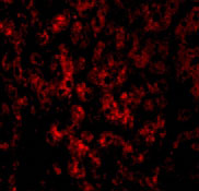3 - DRAM Antibody ASC10498