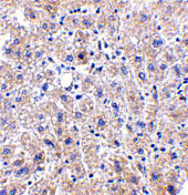2 - DRAM Antibody ASC10498