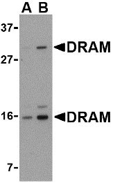 1 - DRAM Antibody ASC10498