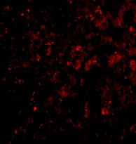3 - DRAM Antibody ASC10499