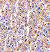 2 - DRAM Antibody ASC10499