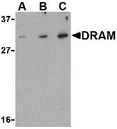 1 - DRAM Antibody ASC10499