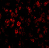 3 - SCO2 Antibody ASC10504