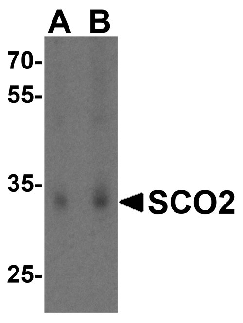 1 - SCO2 Antibody ASC10504