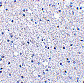 2 - TIGAR Antibody ASC10505