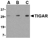 1 - TIGAR Antibody ASC10505