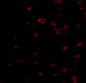 3 - BRSK1 Antibody ASC10518