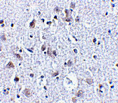 2 - BRSK1 Antibody ASC10518