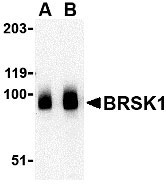 1 - BRSK1 Antibody ASC10518