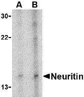 1 - Neuritin Antibody ASC10524