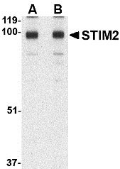 1 - STIM2 Antibody ASC10531