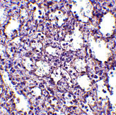 2 - STIM2 Antibody ASC10532