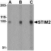 1 - STIM2 Antibody ASC10532