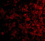 3 - TSLP Receptor Antibody ASC10535