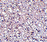 2 - TSLP Receptor Antibody ASC10535