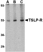 1 - TSLP Receptor Antibody ASC10535