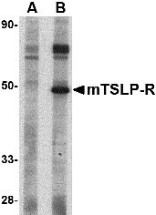 1 - TSLP Receptor Antibody ASC10536