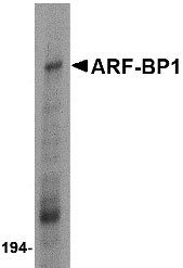 1 - ARF-BP1 Antibody ASC10538