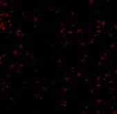3 - Bub1 Antibody ASC10542