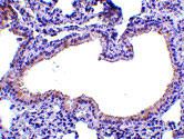 2 - SLPI Antibody ASC10548