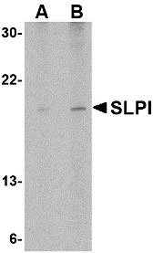 1 - SLPI Antibody ASC10548