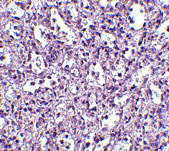 2 - Carabin Antibody ASC10554
