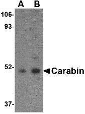 1 - Carabin Antibody ASC10554