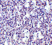 2 - Carabin Antibody ASC10555