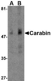 1 - Carabin Antibody ASC10555