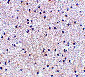 2 - MORF4 Antibody ASC10558