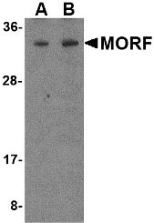 1 - MORF4 Antibody ASC10558