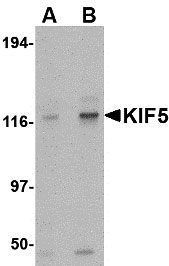 1 - KIF5 Antibody ASC10566