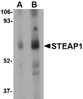 1 - STEAP1 Antibody ASC10572