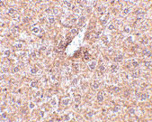 2 - STEAP3 Antibody ASC10574