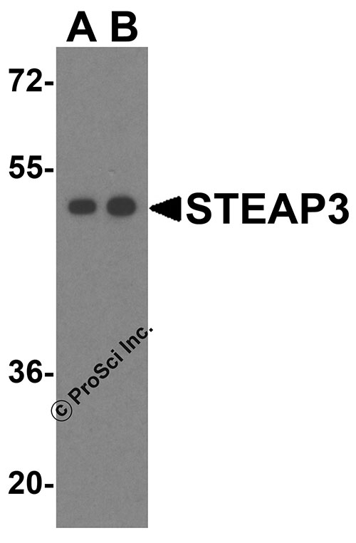 1 - STEAP3 Antibody ASC10574