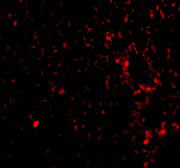 3 - TEM7 Antibody ASC10587